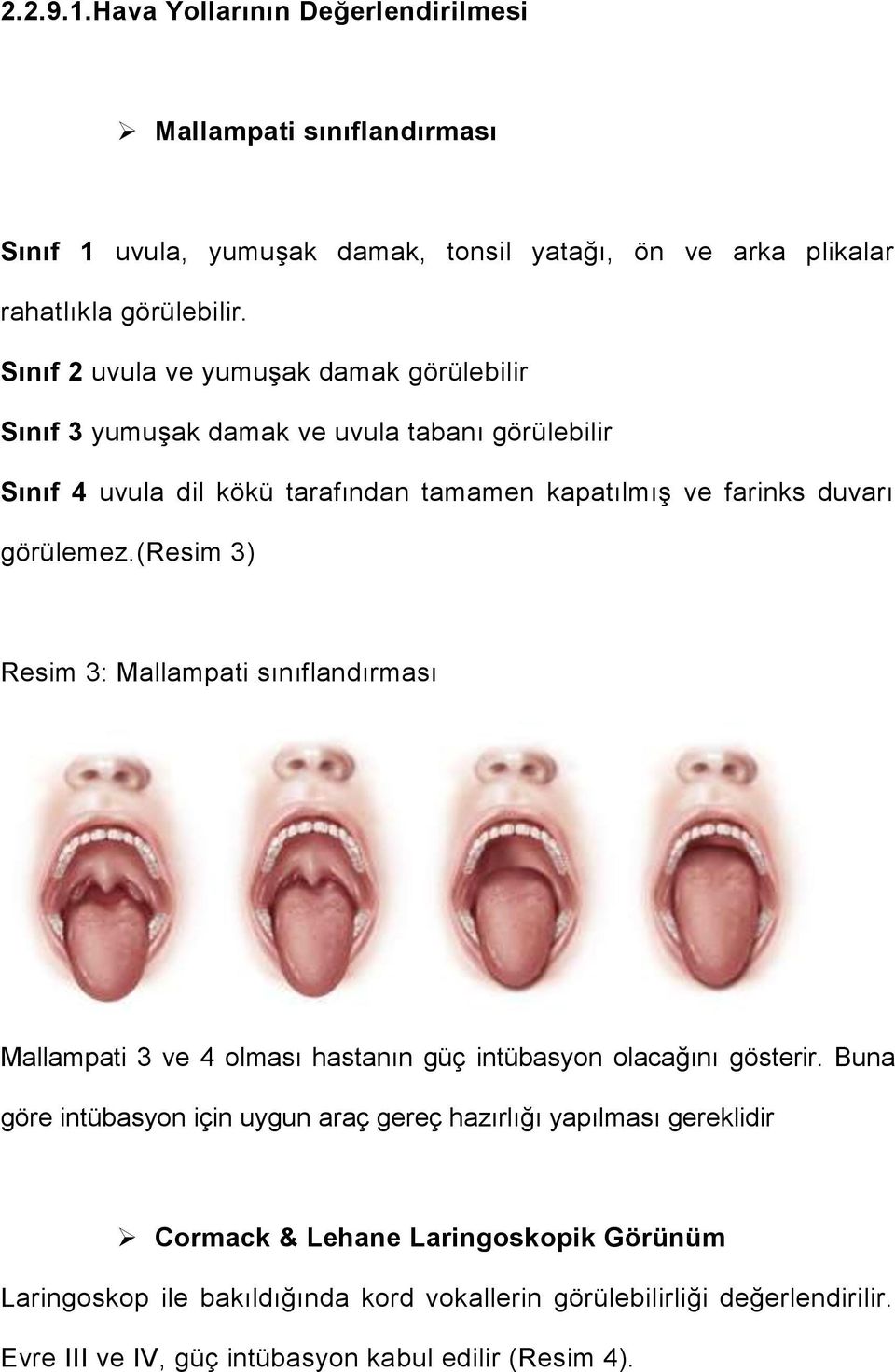 görülemez.(resim 3) Resim 3: Mallampati sınıflandırması Mallampati 3 ve 4 olması hastanın güç intübasyon olacağını gösterir.