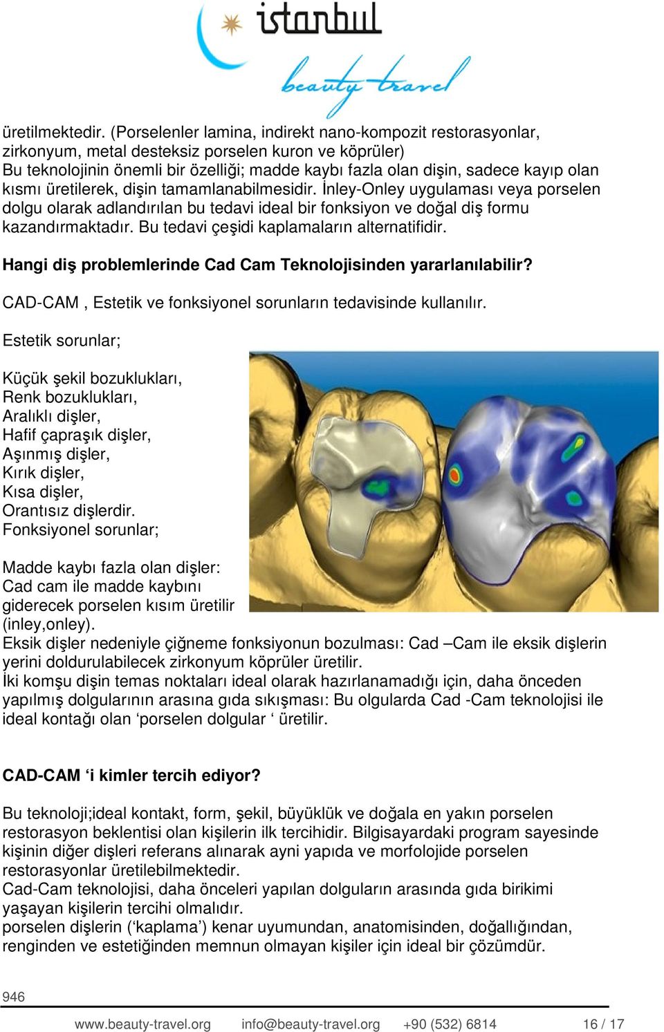 kısmı üretilerek, dişin tamamlanabilmesidir. İnley-Onley uygulaması veya porselen dolgu olarak adlandırılan bu tedavi ideal bir fonksiyon ve doğal diş formu kazandırmaktadır.