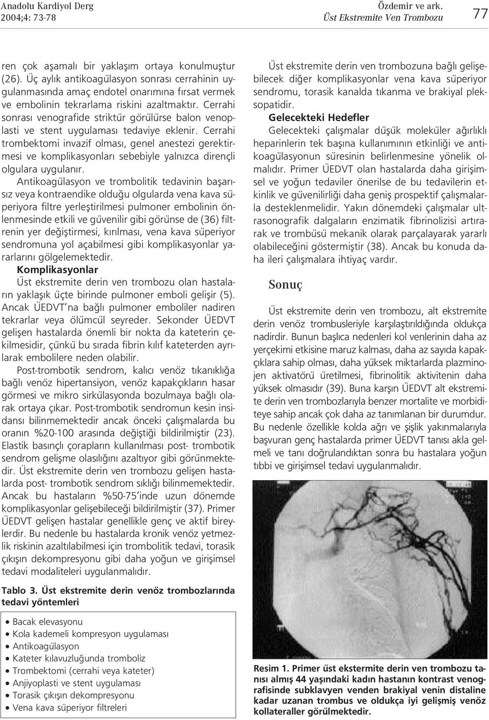 Cerrahi sonras venografide striktür görülürse balon venoplasti ve stent uygulamas tedaviye eklenir.