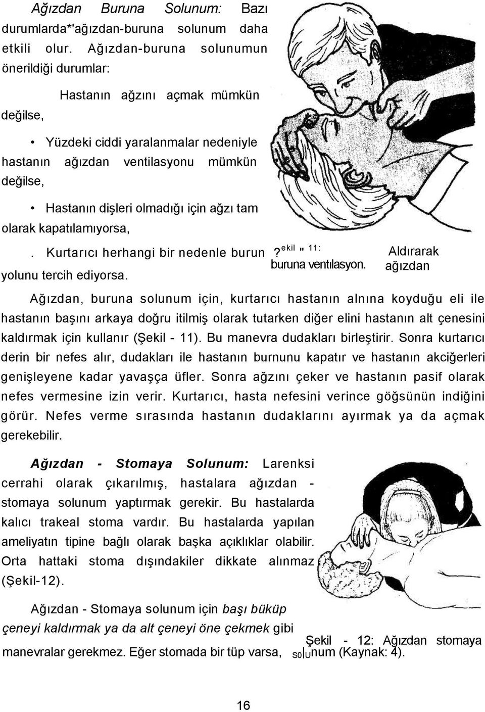 ağzı tam olarak kapatılamıyorsa,. Kurtarıcı herhangi bir nedenle burun? ekil " 11: buruna ventılasyon. yolunu tercih ediyorsa.