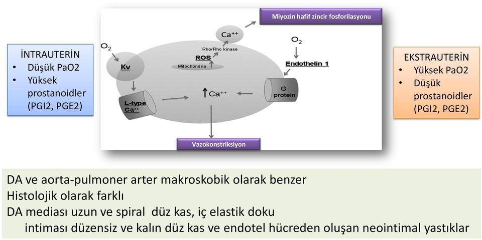 aorta-pulmoner arter makroskobik olarak benzer Histolojik olarak farklı DA mediası uzun ve