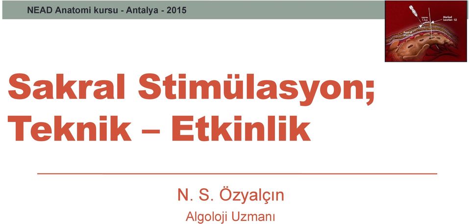 - 2011 - Sakral Stimülasyon;