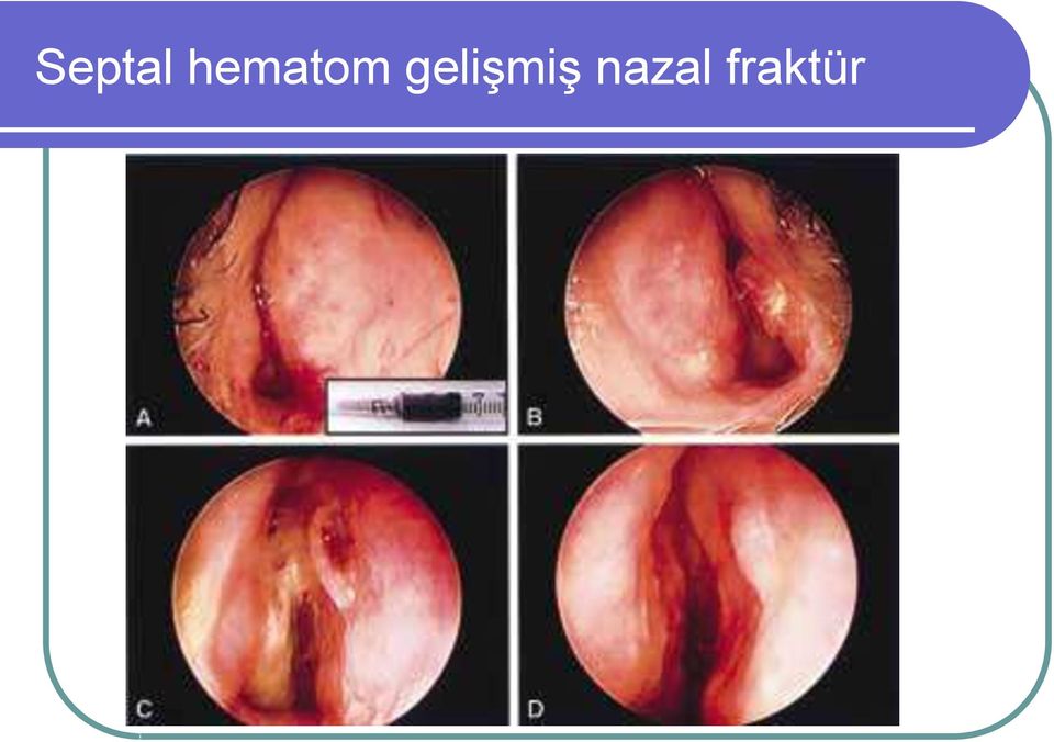 gelişmiş