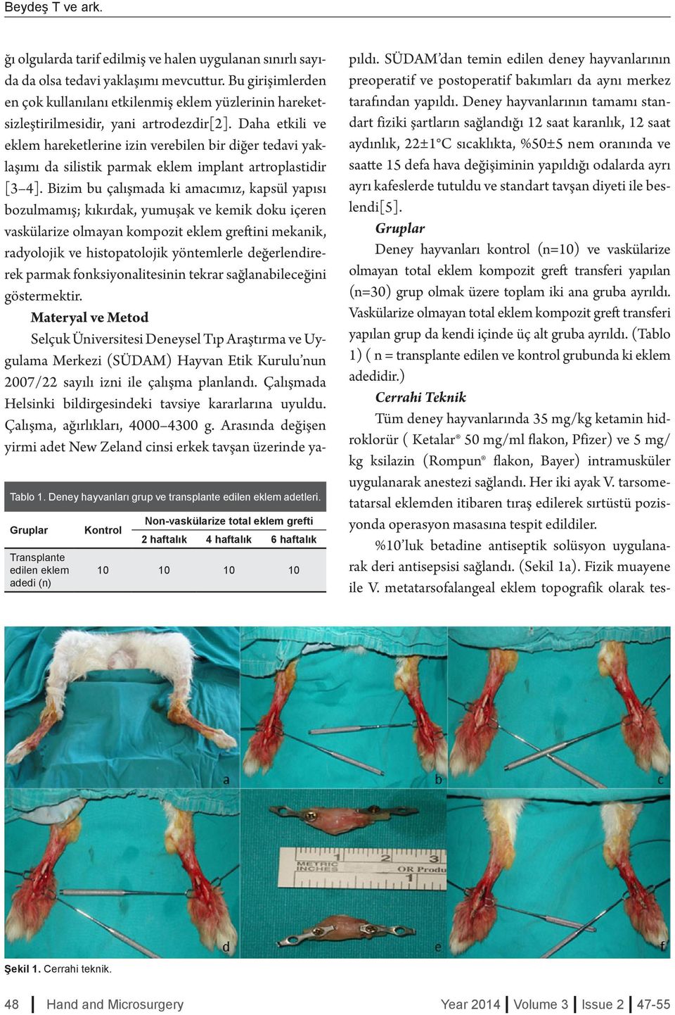 Daha etkili ve eklem hareketlerine izin verebilen bir diğer tedavi yaklaşımı da silistik parmak eklem implant artroplastidir [3 4].