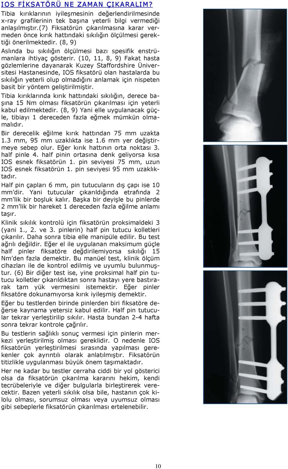 (10, 11, 8, 9) Fakat hasta gözlemlerine dayanarak Kuzey Staffordshire Üniversitesi Hastanesinde, IOS fiksatörü olan hastalarda bu sıkılığın yeterli olup olmadığını anlamak için nispeten basit bir