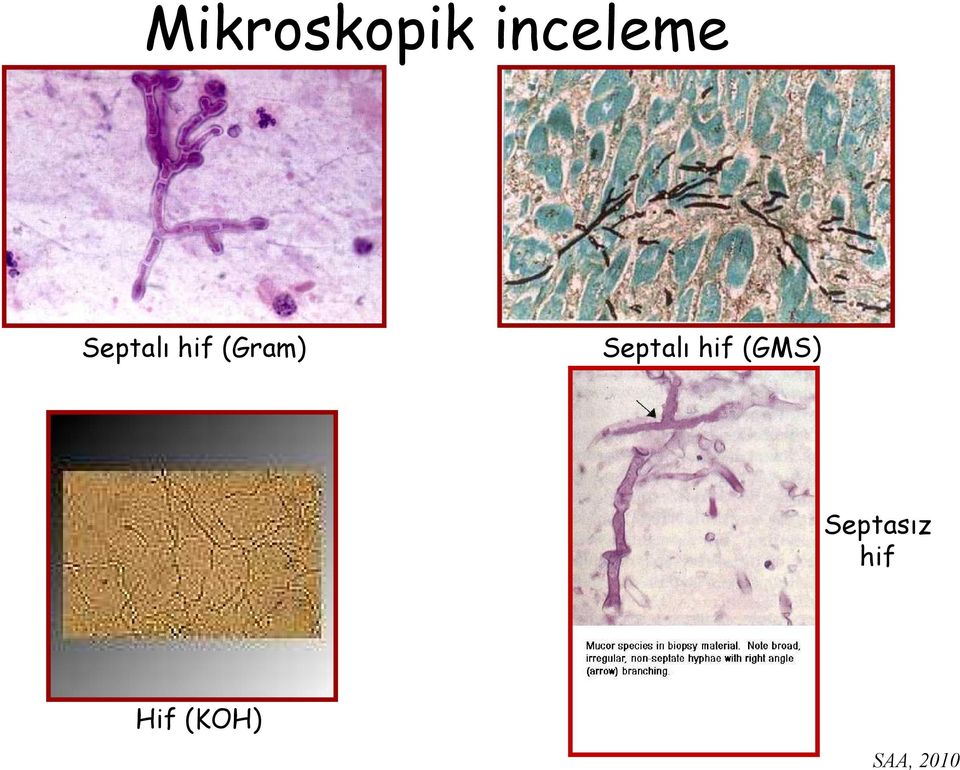 hif (Gram) Septalı