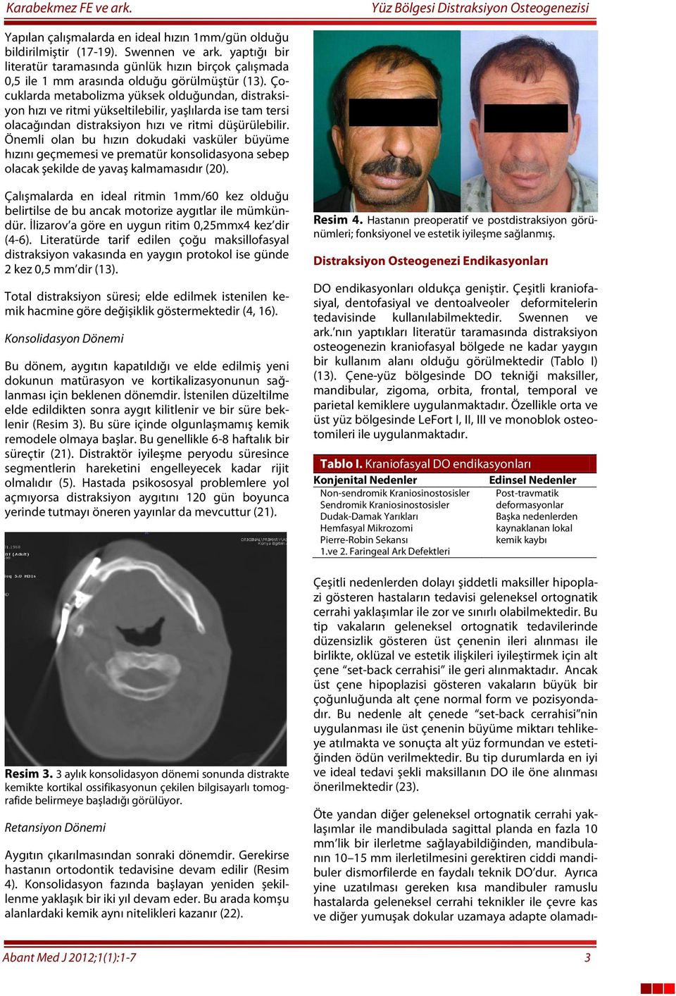 Çocuklarda metabolizma yüksek olduğundan, distraksiyon hızı ve ritmi yükseltilebilir, yaşlılarda ise tam tersi olacağından distraksiyon hızı ve ritmi düşürülebilir.