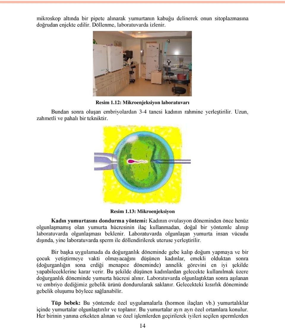 13: Mikroenjeksiyon Kadın yumurtasını dondurma yöntemi: Kadının ovulasyon döneminden önce henüz olgunlaģmamıģ olan yumurta hücresinin ilaç kullanmadan, doğal bir yöntemle alınıp laboratuvarda