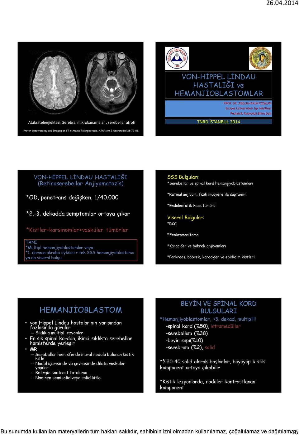 at 3T in Ataxia Telengiectasia, AJNR Am J Neuroradiol 28:79-83. VON-HİPPEL LİNDAU HASTALIĞI (Retinoserebellar Anjiyomatozis) *OD, penetrans değişken, 1/40.