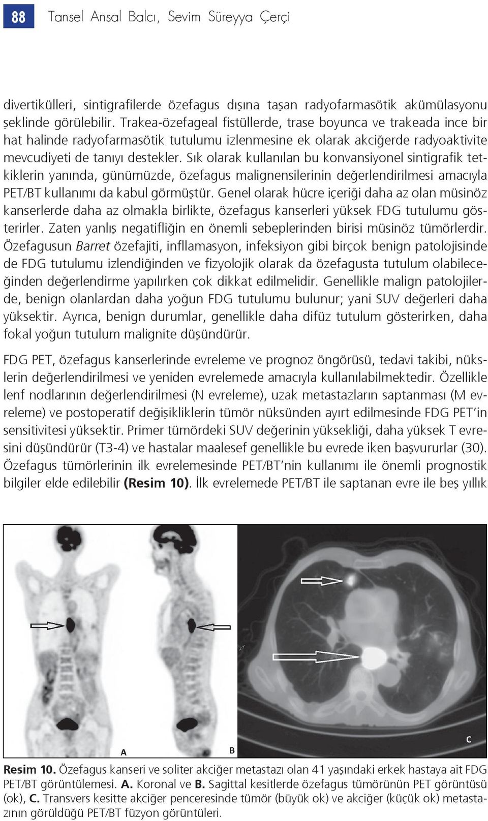 Sık olarak kullanılan bu konvansiyonel sintigrafik tetkiklerin yanında, günümüzde, özefagus malignensilerinin değerlendirilmesi amacıyla PET/BT kullanımı da kabul görmüştür.