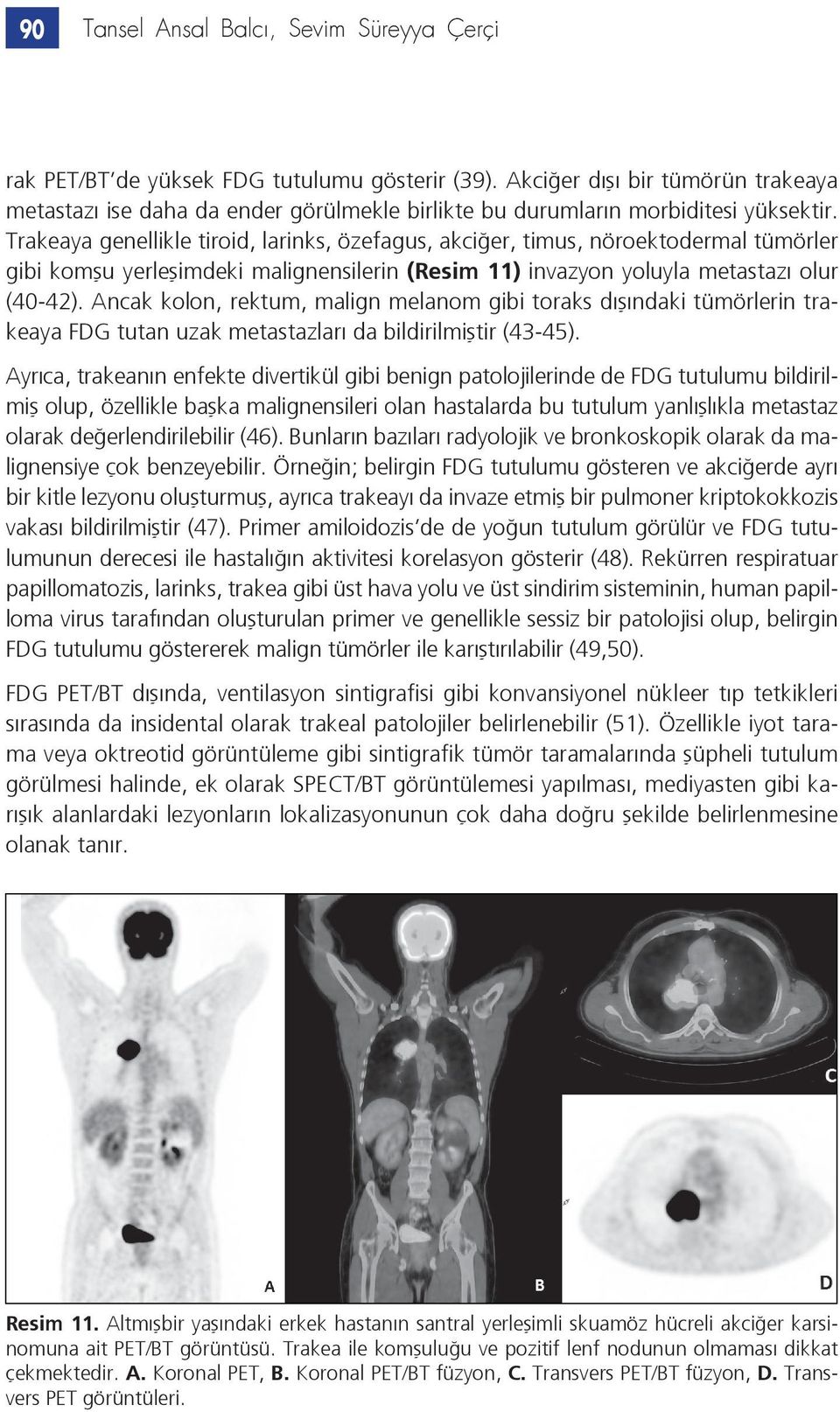 Trakeaya genellikle tiroid, larinks, özefagus, akciğer, timus, nöroektodermal tümörler gibi komşu yerleşimdeki malignensilerin (Resim 11) invazyon yoluyla metastazı olur (40-42).