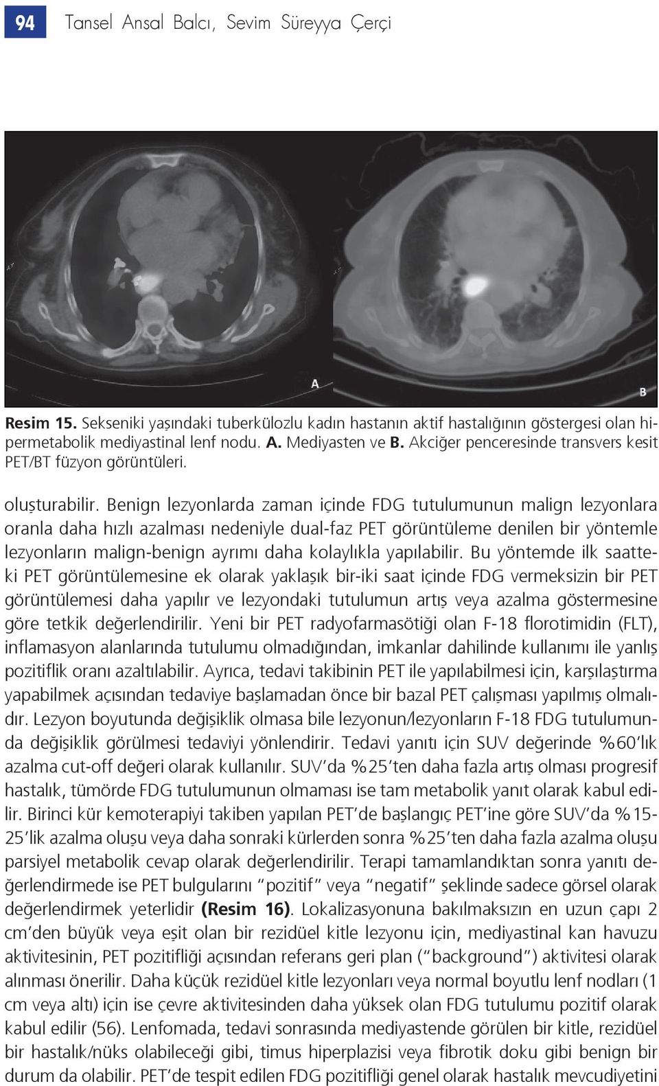 Benign lezyonlarda zaman içinde FDG tutulumunun malign lezyonlara oranla daha hızlı azalması nedeniyle dual-faz PET görüntüleme denilen bir yöntemle lezyonların malign-benign ayrımı daha kolaylıkla