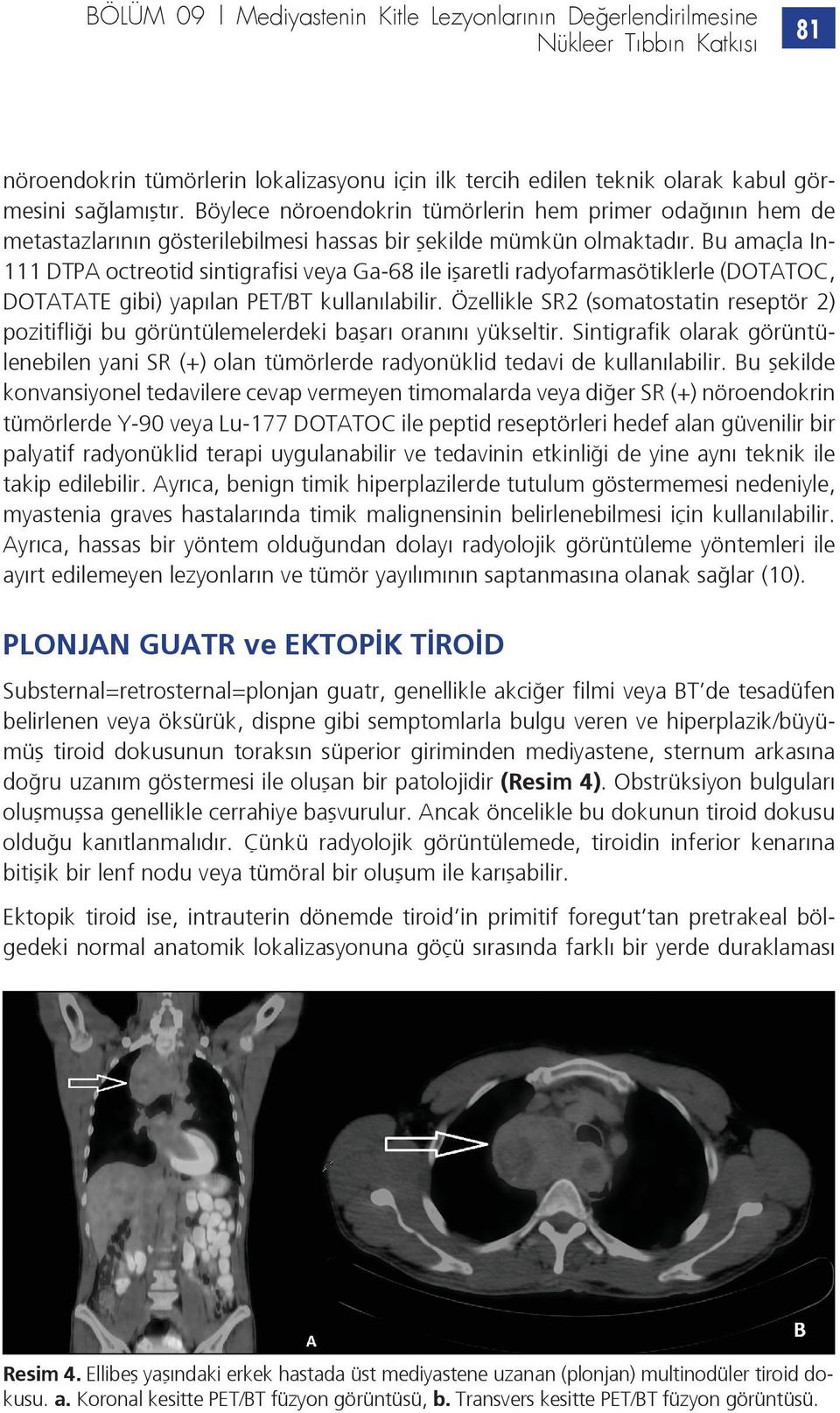 Bu amaçla In- 111 DTPA octreotid sintigrafisi veya Ga-68 ile işaretli radyofarmasötiklerle (DOTATOC, DOTATATE gibi) yapılan PET/BT kullanılabilir.