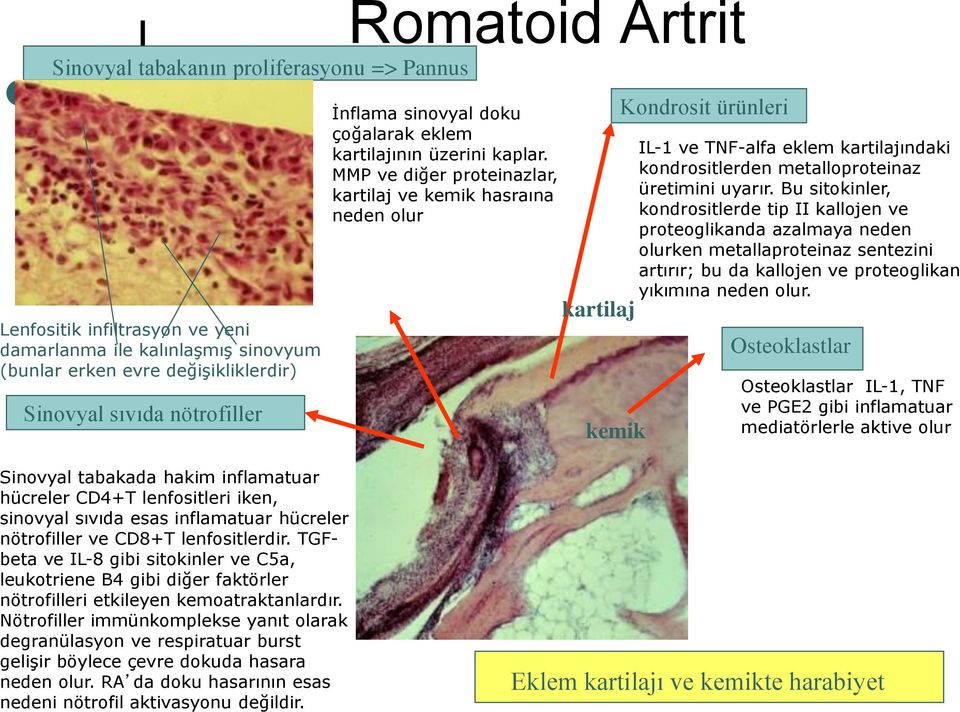 MMP ve diğer proteinazlar, kartilaj ve kemik hasraına neden olur kartilaj kemik Kondrosit ürünleri IL-1 ve TNF-alfa eklem kartilajındaki kondrositlerden metalloproteinaz üretimini uyarır.