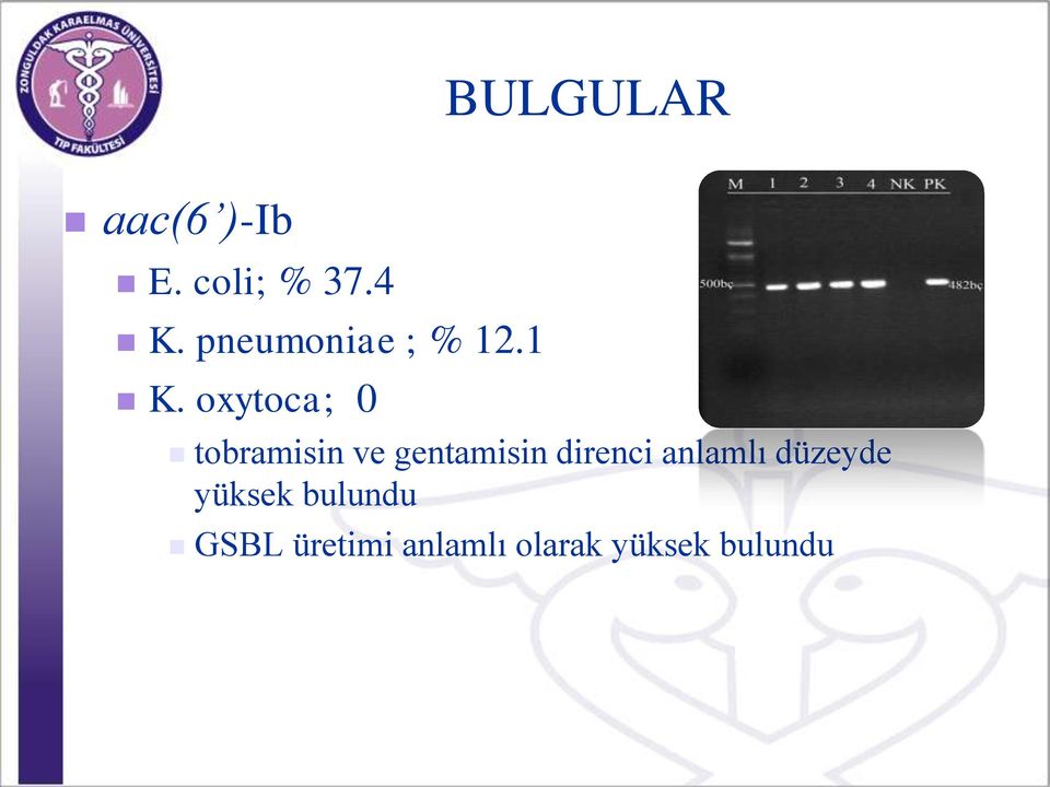 oxytoca; 0 tobramisin ve gentamisin direnci