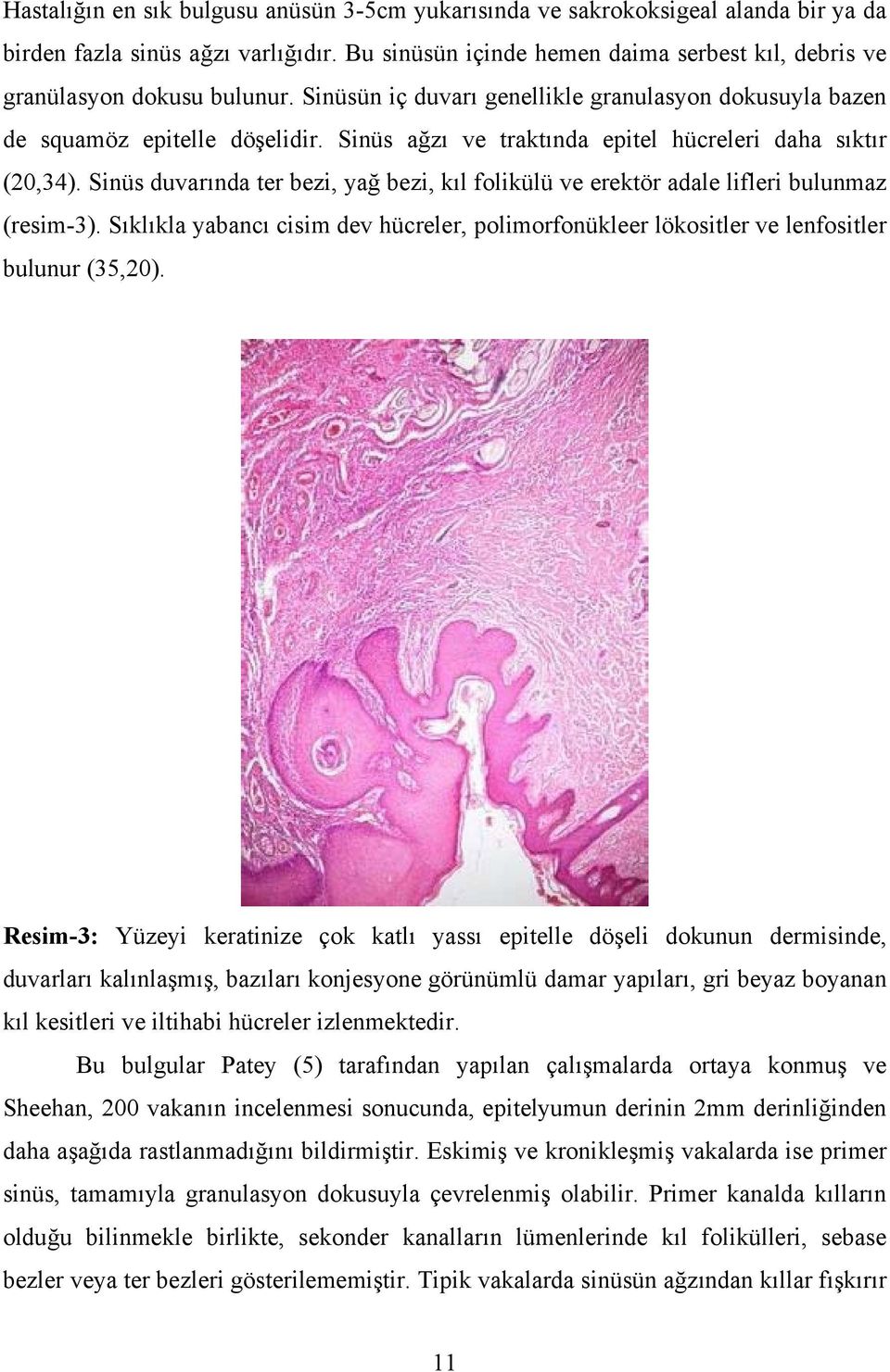 Sinüs ağzı ve traktında epitel hücreleri daha sıktır (20,34). Sinüs duvarında ter bezi, yağ bezi, kıl folikülü ve erektör adale lifleri bulunmaz (resim-3).