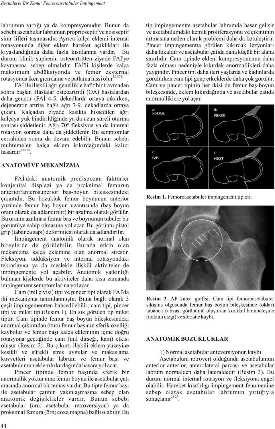 Bu durum klinik şüphenin osteoartritten ziyade FAI'ye kaymasına sebep olmalıdır. FAİ'li kişilerde kalça maksimum abdüksiyonda ve femur eksternal rotasyonda iken gıcırdama ve patlama hissi olur3,22-24.