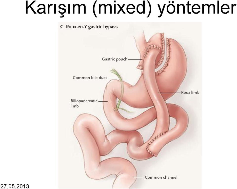 Karışım