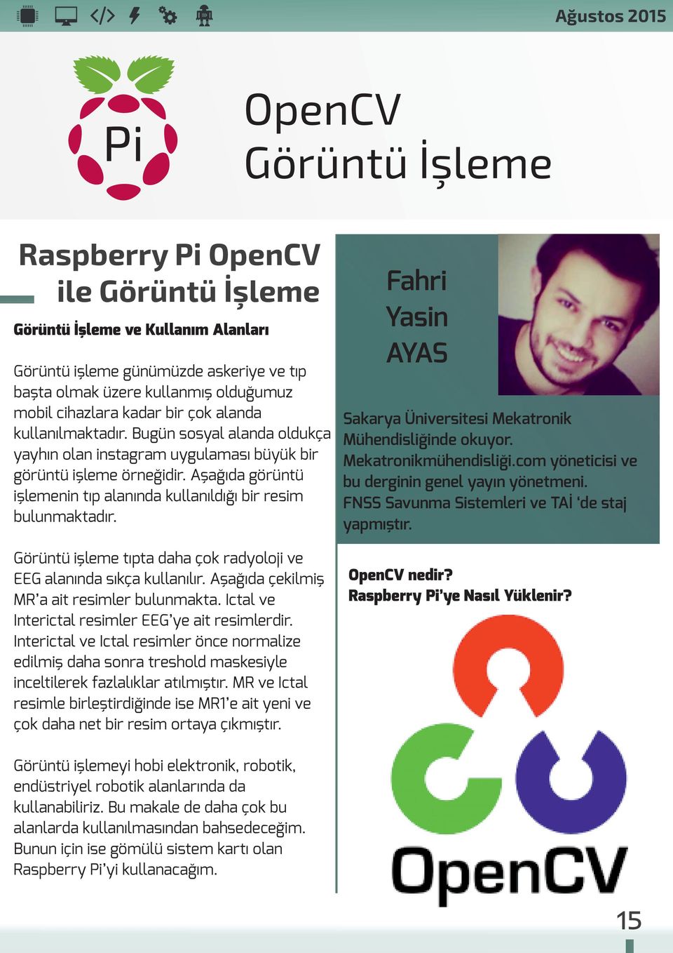 Aşağıda görüntü işlemenin tıp alanında kullanıldığı bir resim bulunmaktadır. Görüntü işleme tıpta daha çok radyoloji ve EEG alanında sıkça kullanılır. Aşağıda çekilmiş MR a ait resimler bulunmakta.