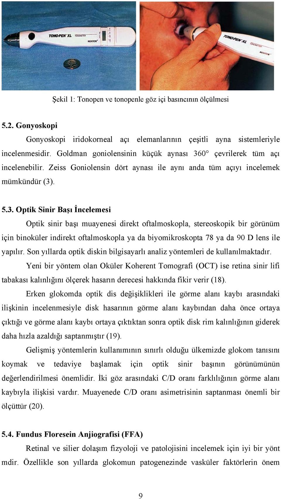 0 çevrilerek tüm açı incelenebilir. Zeiss Goniolensin dört aynası ile aynı anda tüm açıyı incelemek mümkündür (3)