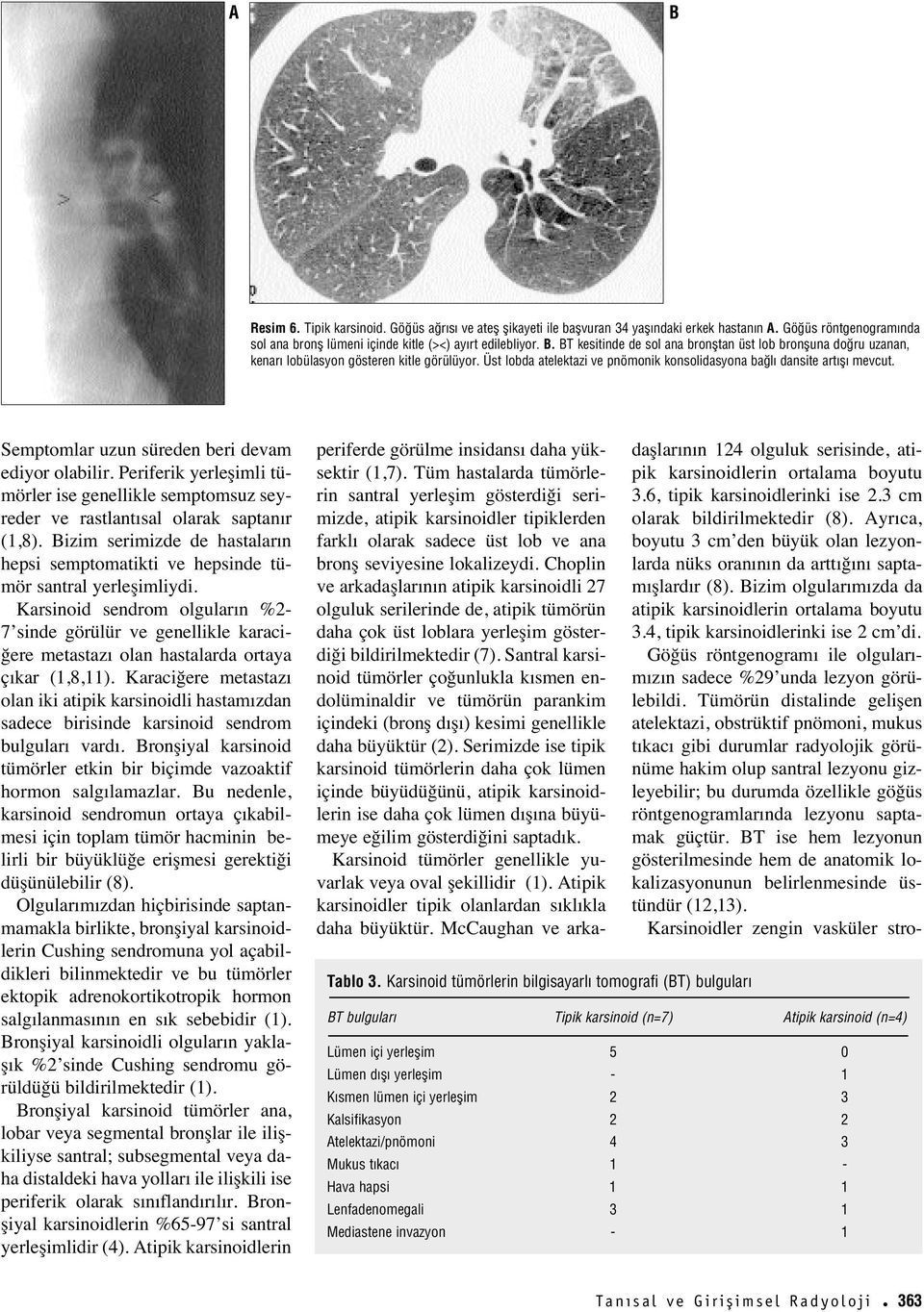 Periferik yerleşimli tümörler ise genellikle semptomsuz seyreder ve rastlant sal olarak saptan r (1,8). Bizim serimizde de hastalar n hepsi semptomatikti ve hepsinde tümör santral yerleşimliydi.