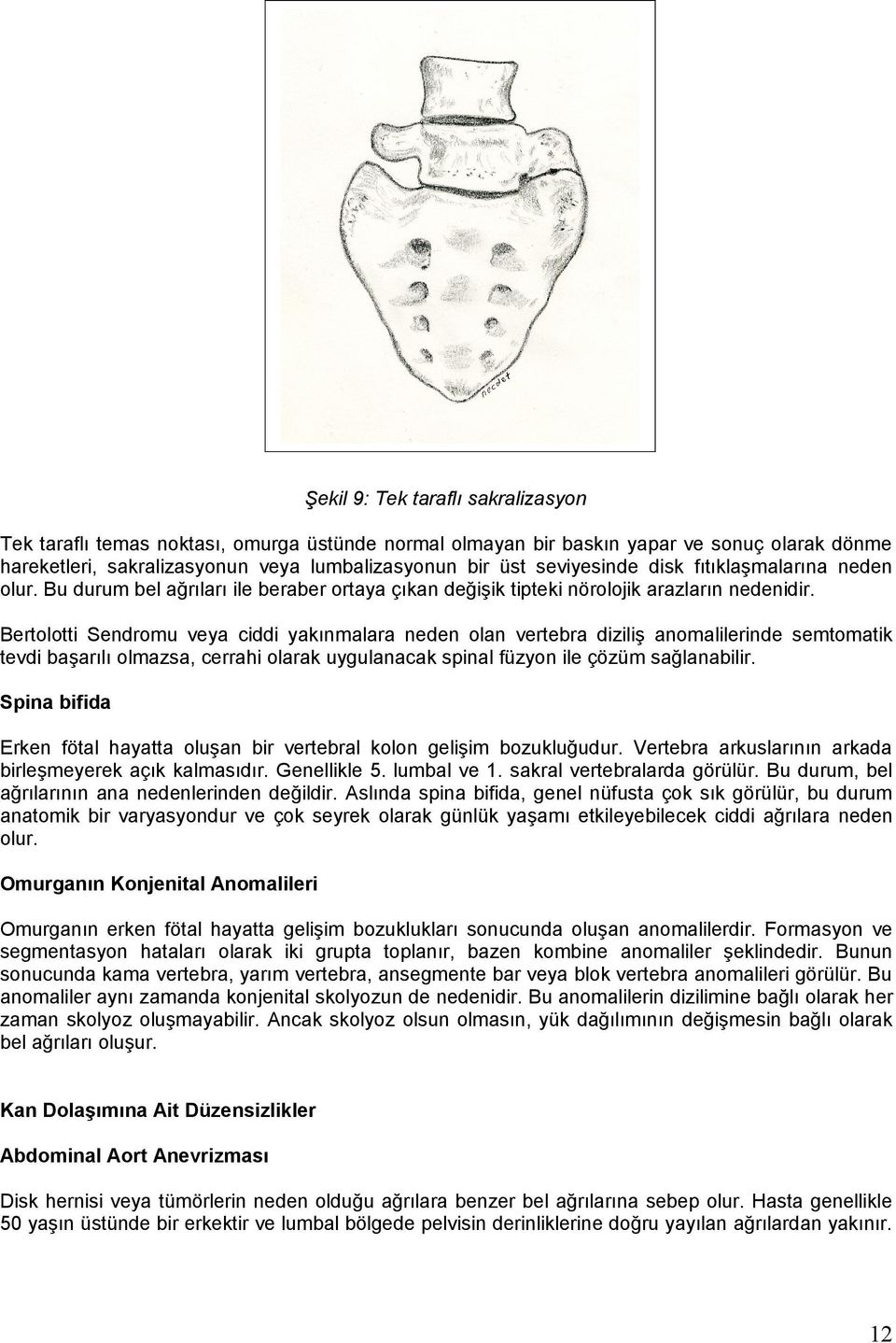 Bertolotti Sendromu veya ciddi yakınmalara neden olan vertebra diziliş anomalilerinde semtomatik tevdi başarılı olmazsa, cerrahi olarak uygulanacak spinal füzyon ile çözüm sağlanabilir.