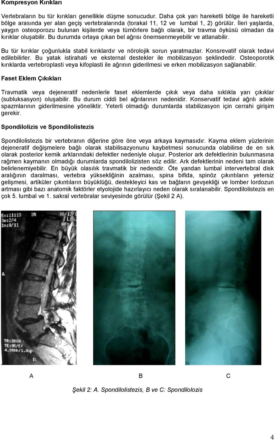 İleri yaşlarda, yaygın osteoporozu bulunan kişilerde veya tümörlere bağlı olarak, bir travma öyküsü olmadan da kırıklar oluşabilir. Bu durumda ortaya çıkan bel ağrısı önemsenmeyebilir ve atlanabilir.