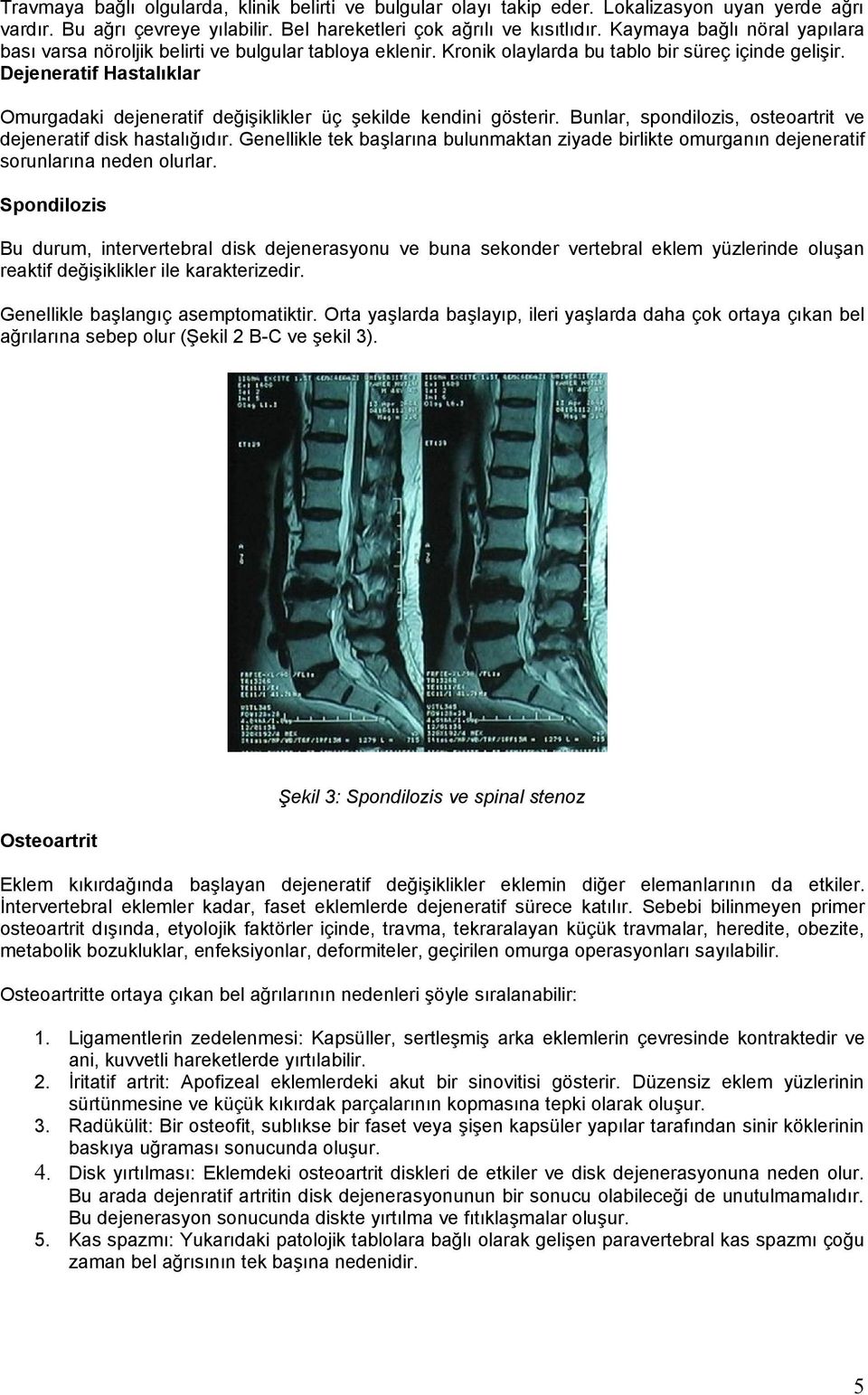 Dejeneratif Hastalıklar Omurgadaki dejeneratif değişiklikler üç şekilde kendini gösterir. Bunlar, spondilozis, osteoartrit ve dejeneratif disk hastalığıdır.