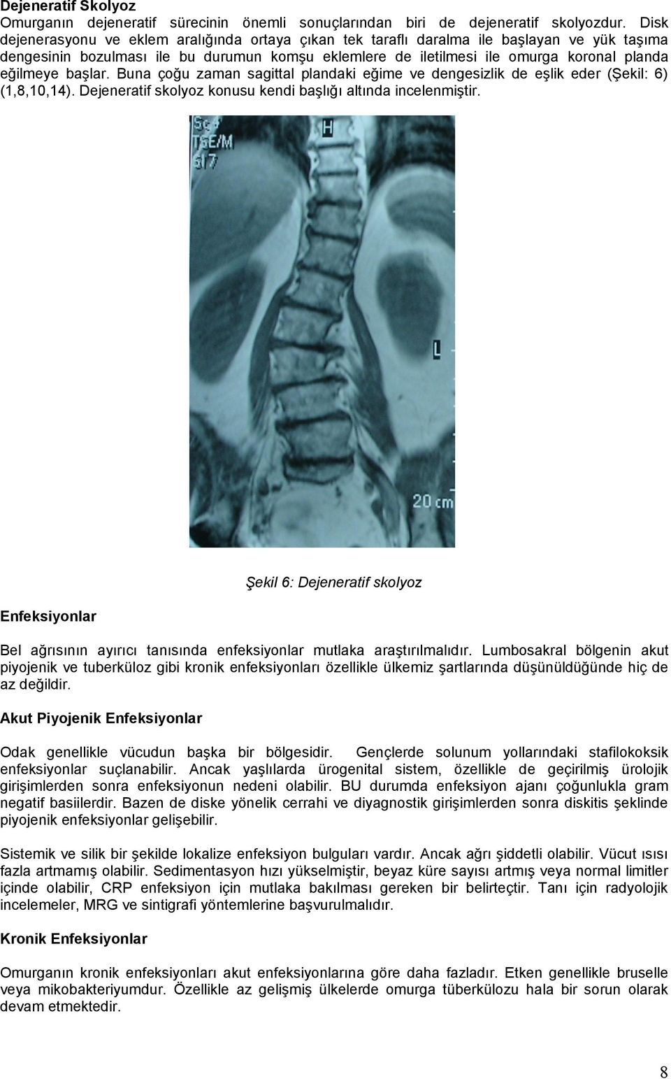 başlar. Buna çoğu zaman sagittal plandaki eğime ve dengesizlik de eşlik eder (Şekil: 6) (1,8,10,14). Dejeneratif skolyoz konusu kendi başlığı altında incelenmiştir.