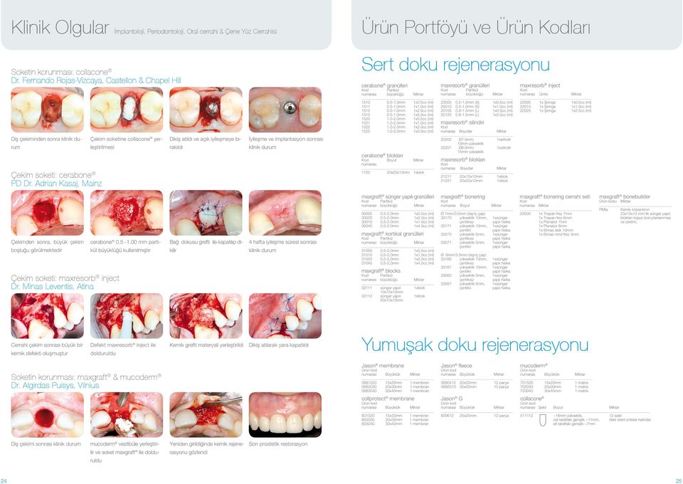 Adrian Kasaj, Mainz Çekim soketine collacone yerleştirilmesi Dikiş atıldı ve açık iyileşmeye bırakıldı İyileşme ve implantasyon sonrası klinik durum Sert doku rejenerasyonu cerabone granülleri