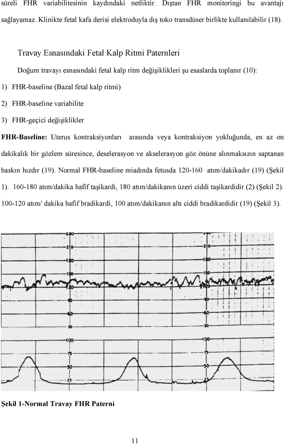 variabilite 3) FHR-geçici değişiklikler FHR-Baseline: Uterus kontraksiyonları arasında veya kontraksiyon yokluğunda, en az on dakikalık bir gözlem süresince, deselerasyon ve akselerasyon göz önüne