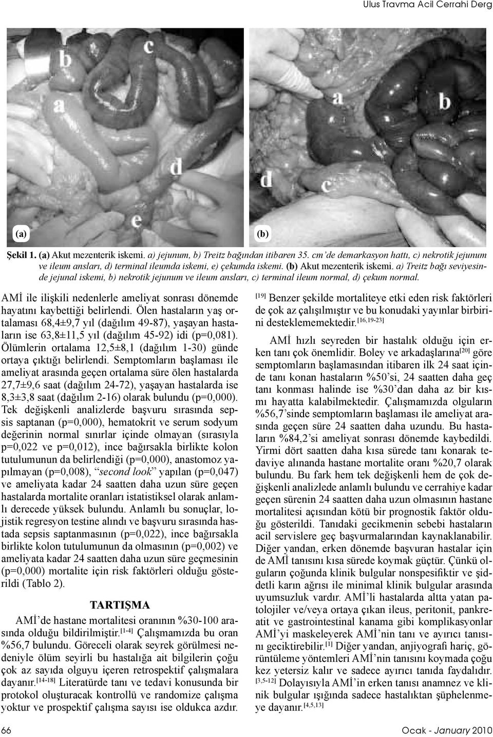 a) Treitz bağı seviyesinde jejunal iskemi, b) nekrotik jejunum ve ileum ansları, c) terminal ileum normal, d) çekum normal.