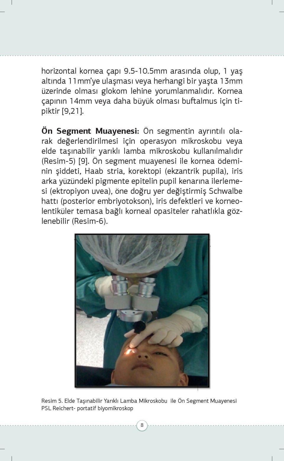 Ön Segment Muayenesi: Ön segmentin ayrıntılı olarak değerlendirilmesi için operasyon mikroskobu veya elde taşınabilir yarıklı lamba mikroskobu kullanılmalıdır (Resim-5) [9].