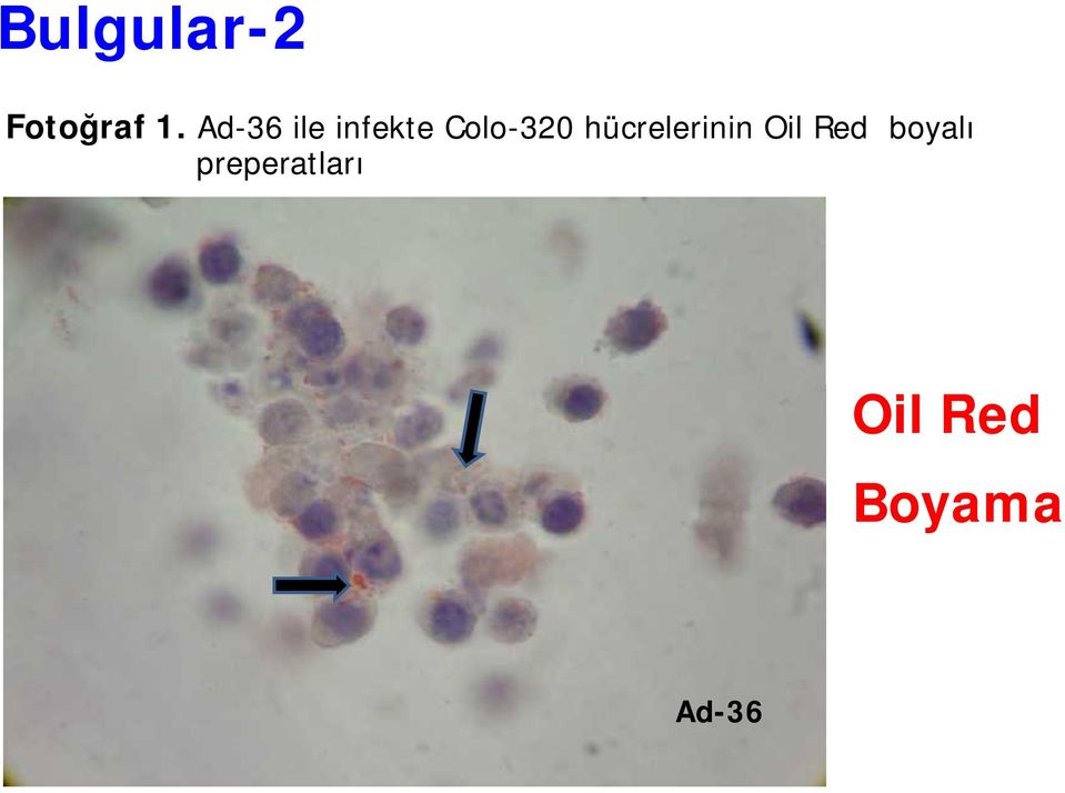 hücrelerinin Oil Red boyalı