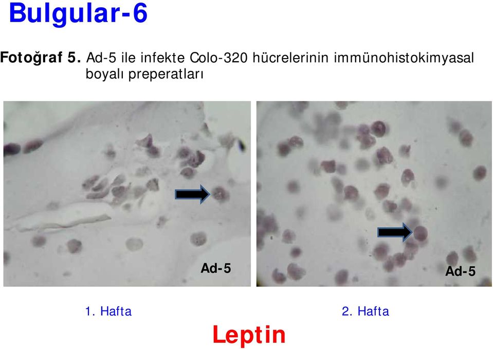 hücrelerinin immünohistokimyasal