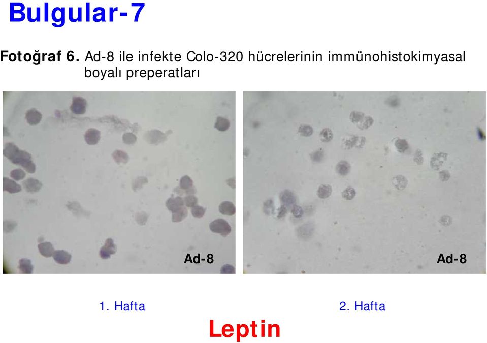 hücrelerinin immünohistokimyasal