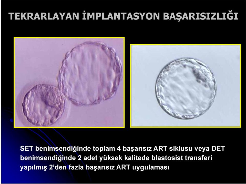 veya DET benimsendiğinde 2 adet yüksek kalitede