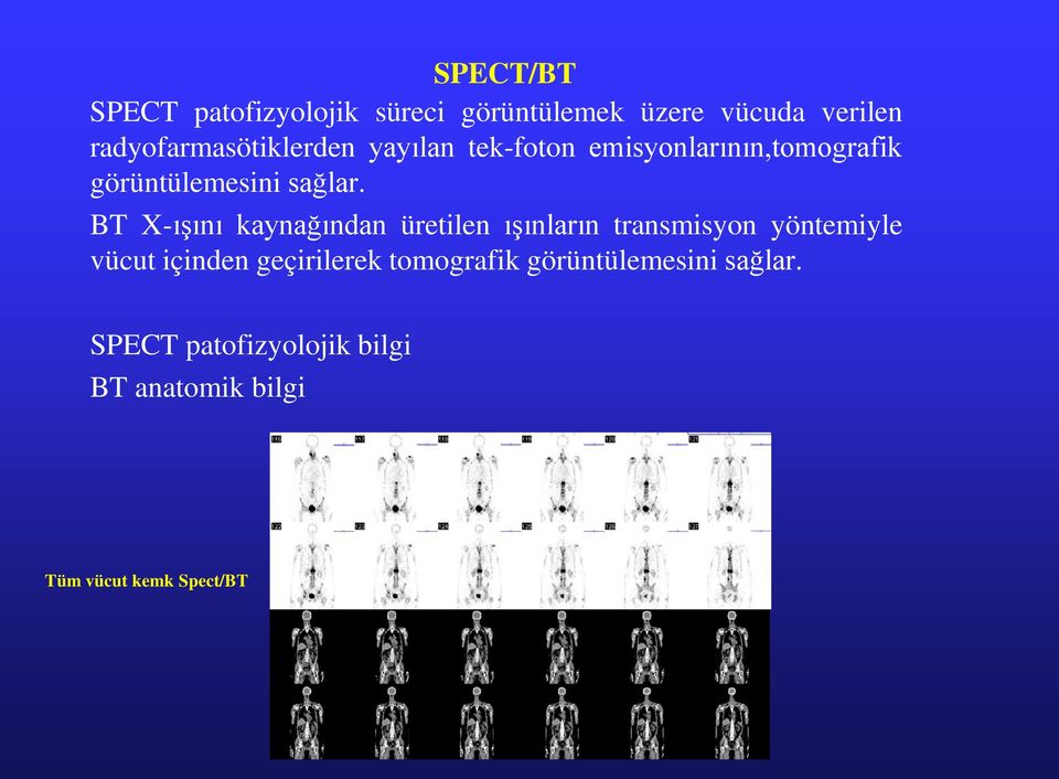 BT X-ışını kaynağından üretilen ışınların transmisyon yöntemiyle vücut içinden