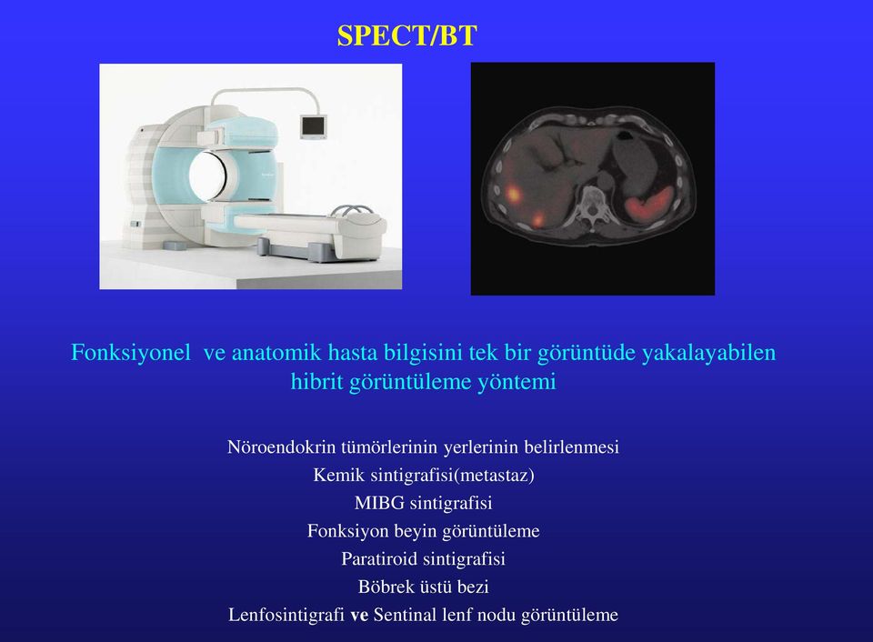 Kemik sintigrafisi(metastaz) MIBG sintigrafisi Fonksiyon beyin görüntüleme