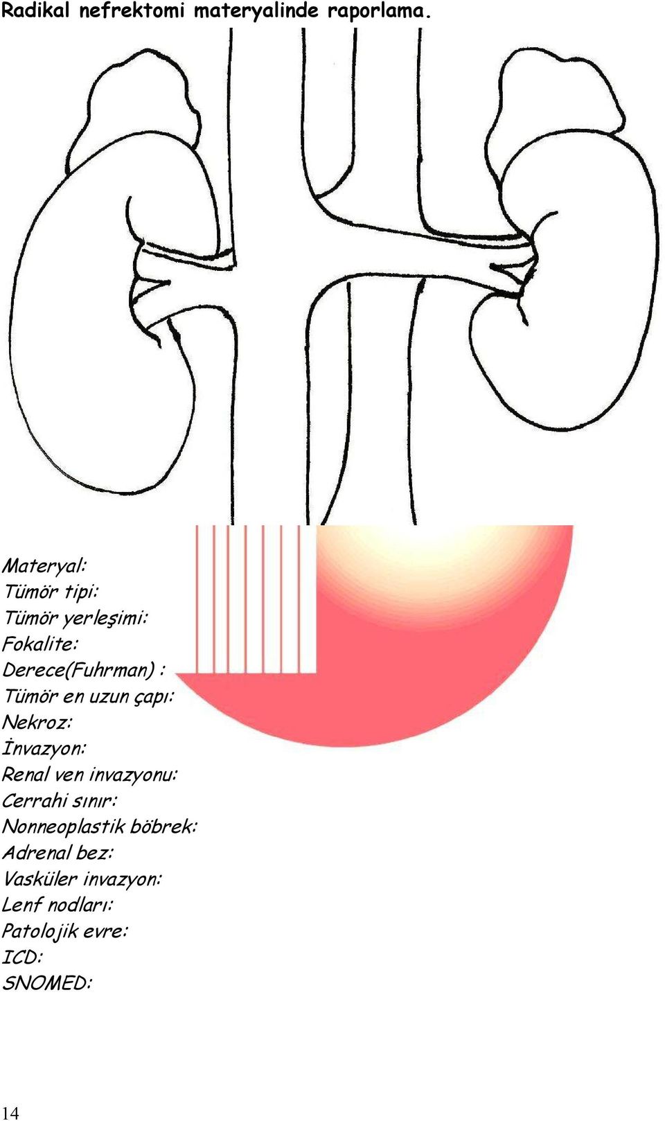 Tümör en uzun çapı: Nekroz: Đnvazyon: Renal ven invazyonu: Cerrahi