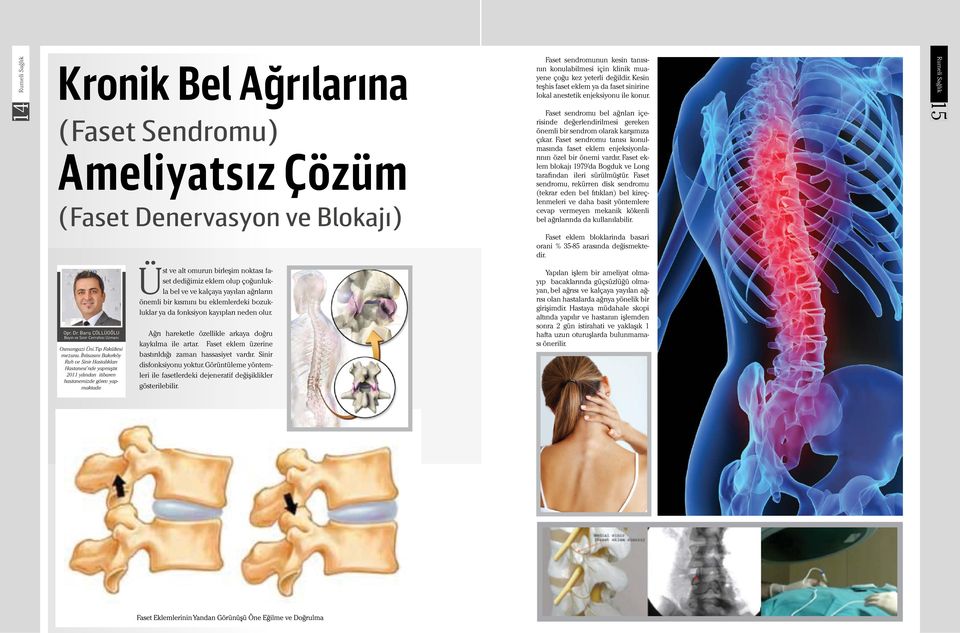 Faset sendromu tanısı konulmasında faset eklem enjeksiyonlarının özel bir önemi vardır. Faset eklem blokajı 1979 da Bogduk ve Long tarafindan ileri sürülmüştür.