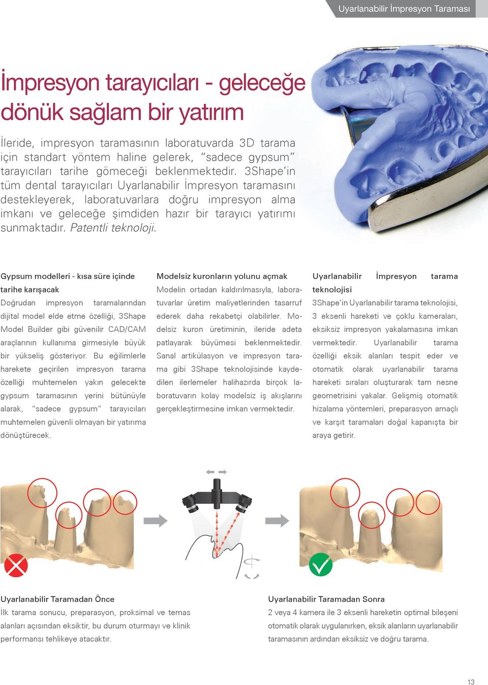 3Shape in tüm dental tarayıcıları Uyarlanabilir İmpresyon taramasını destekleyerek, laboratuvarlara doğru impresyon alma imkanı ve geleceğe şimdiden hazır bir tarayıcı yatırımı sunmaktadır.