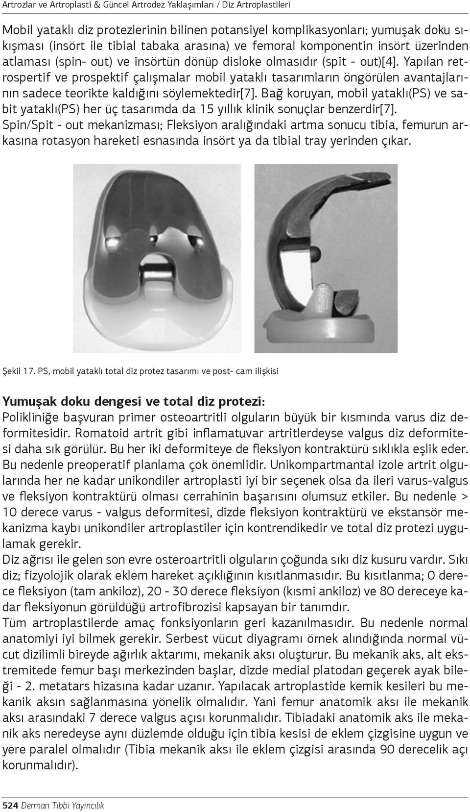 Yapılan retrospertif ve prospektif çalışmalar mobil yataklı tasarımların öngörülen avantajlarının sadece teorikte kaldığını söylemektedir[7].