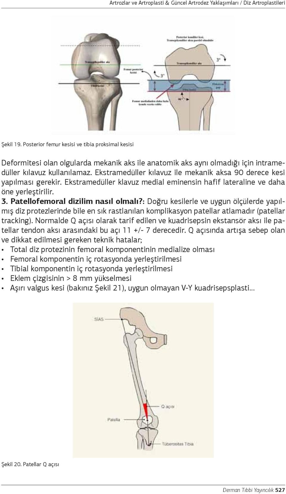 Ekstramedüller kılavuz ile mekanik aksa 90 derece kesi yapılması gerekir. Ekstramedüller klavuz medial eminensin hafif lateraline ve daha öne yerleştirilir. 3. Patellofemoral dizilim nasıl olmalı?