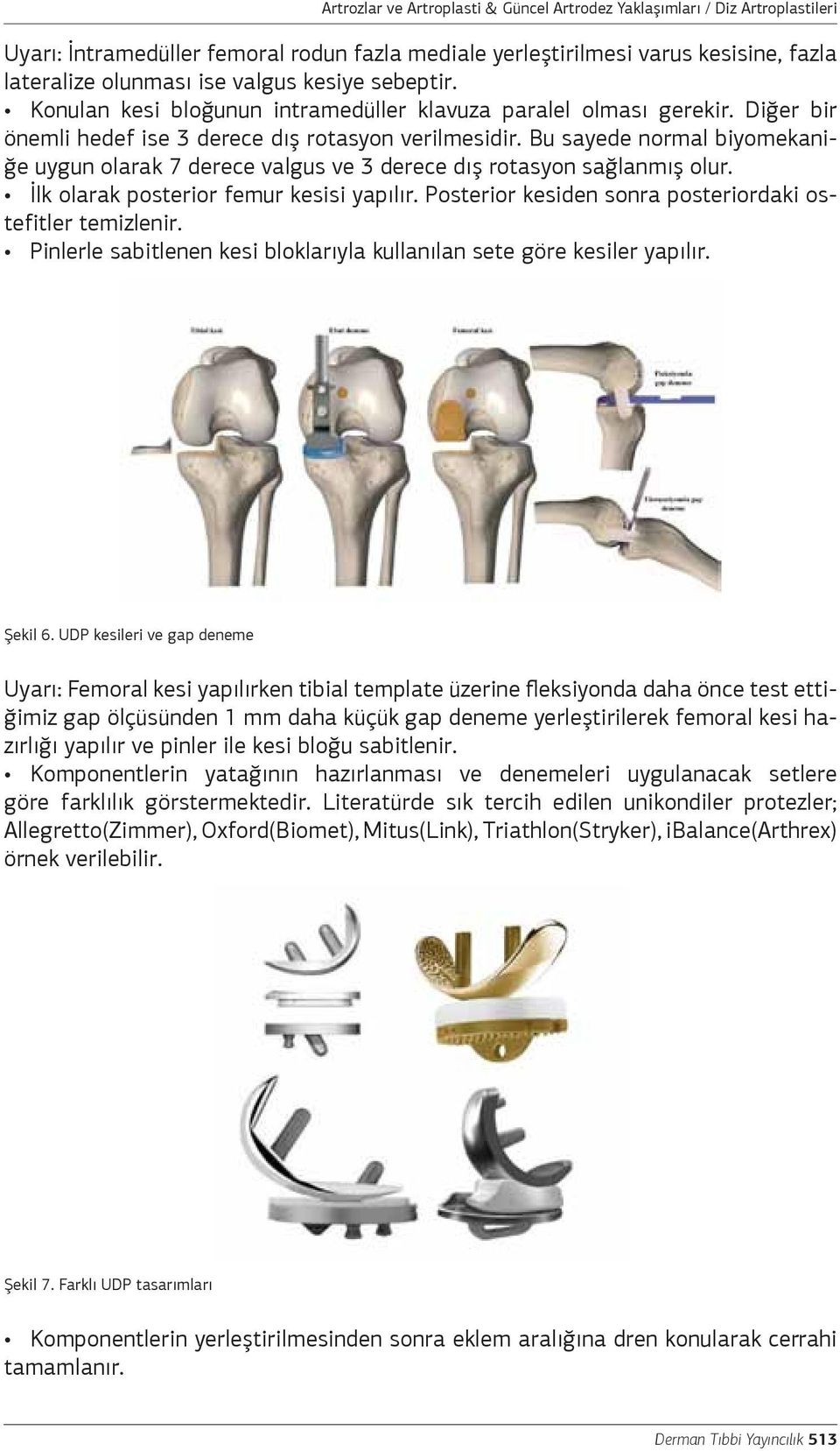 Bu sayede normal biyomekaniğe uygun olarak 7 derece valgus ve 3 derece dış rotasyon sağlanmış olur. İlk olarak posterior femur kesisi yapılır.