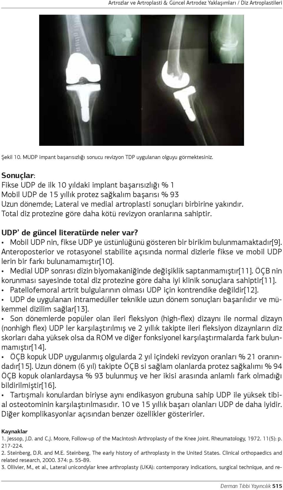 Total diz protezine göre daha kötü revizyon oranlarına sahiptir. UDP de güncel literatürde neler var? Mobil UDP nin, fikse UDP ye üstünlüğünü gösteren bir birikim bulunmamaktadır[9].