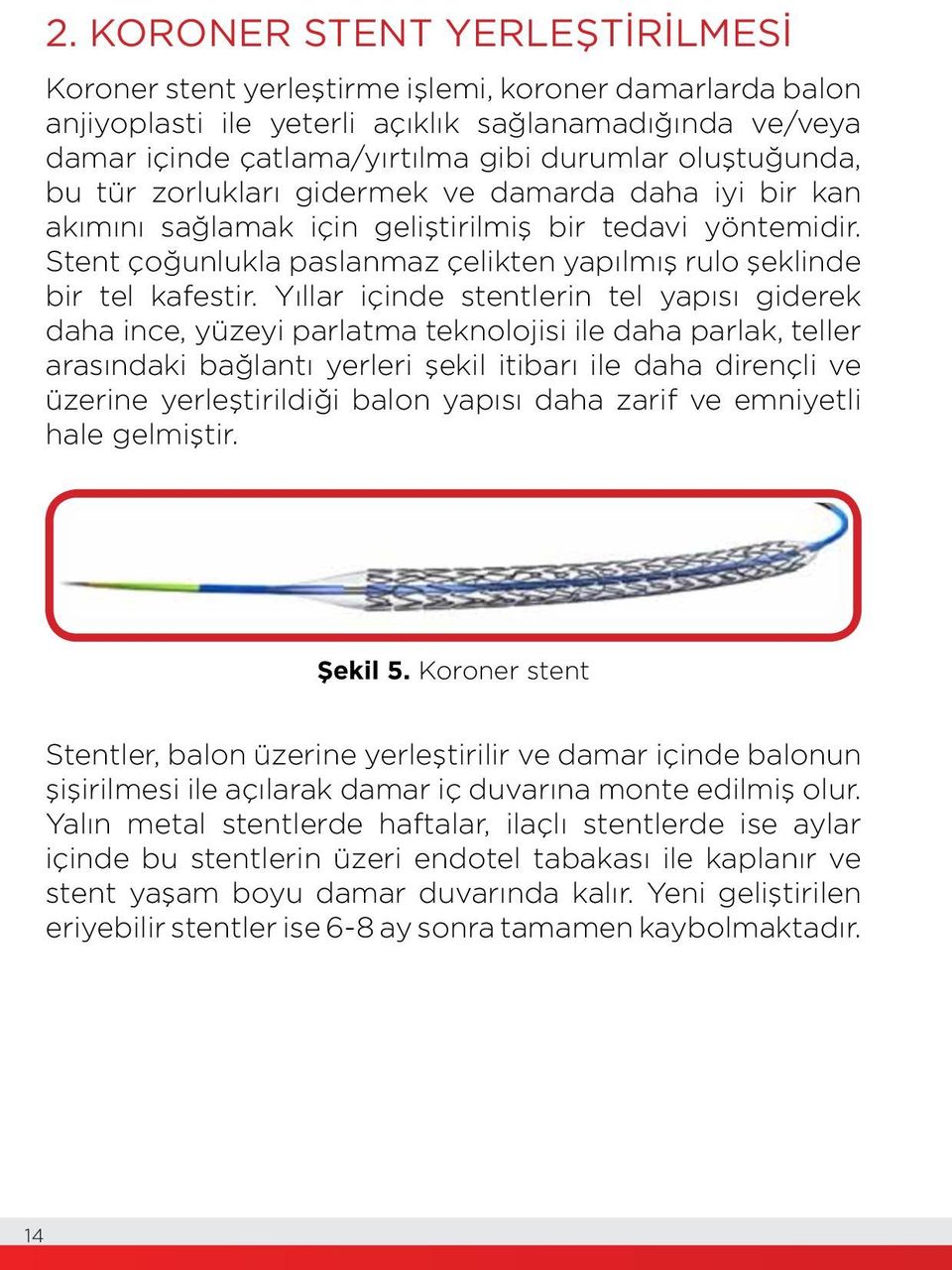 Stent çoğunlukla paslanmaz çelikten yapılmış rulo şeklinde bir tel kafestir.