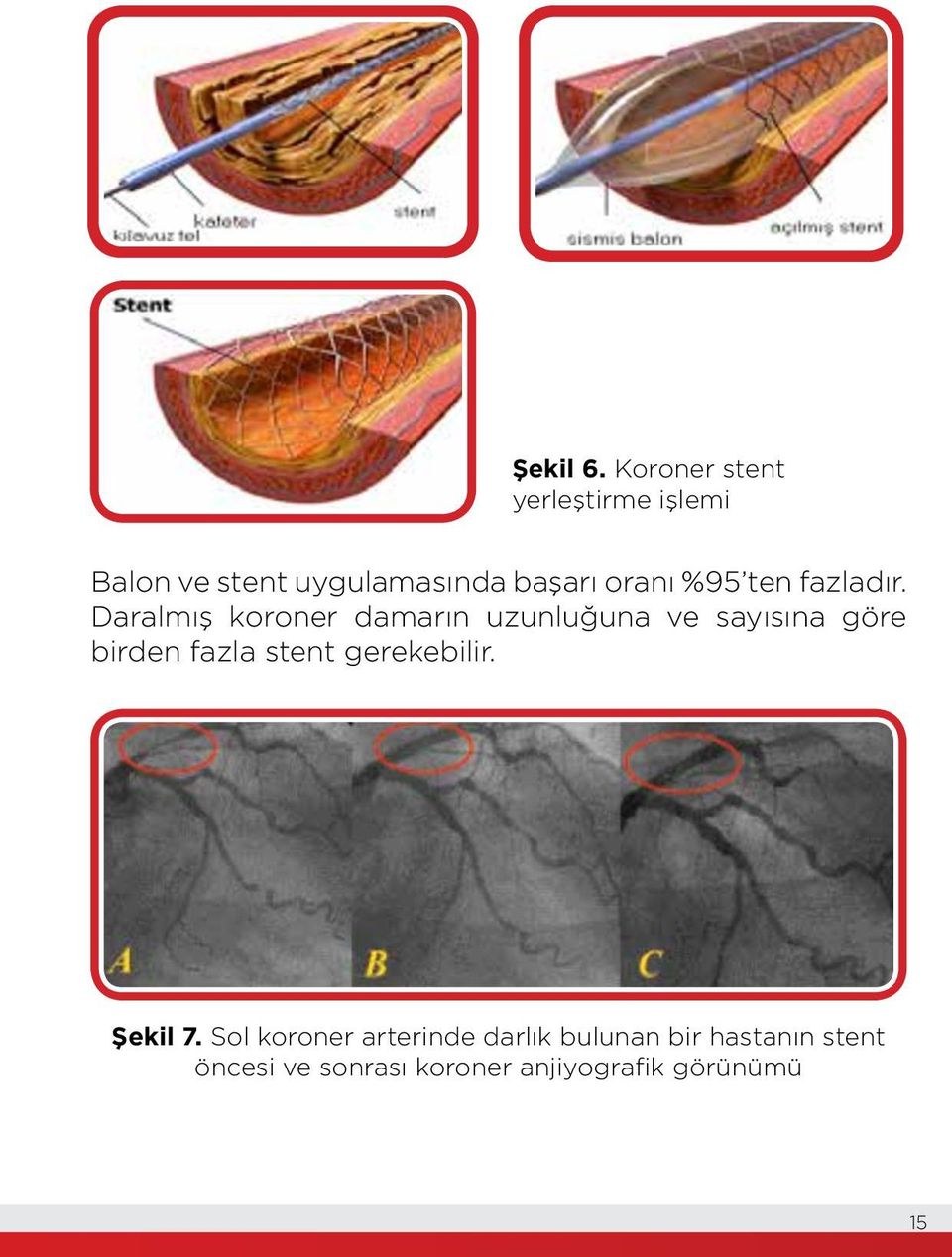 %95 ten fazladır.