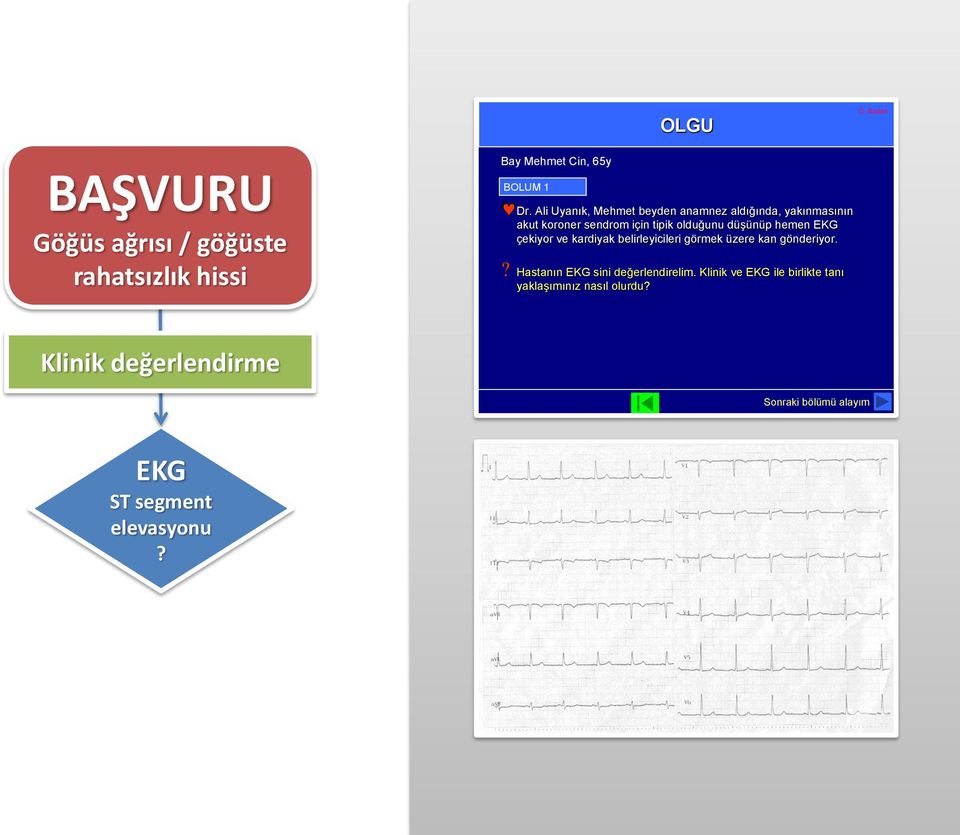 hemen EKG çekiyor ve kardiyak belirleyicileri görmek üzere kan gönderiyor.? Hastanın EKG sini değerlendirelim.