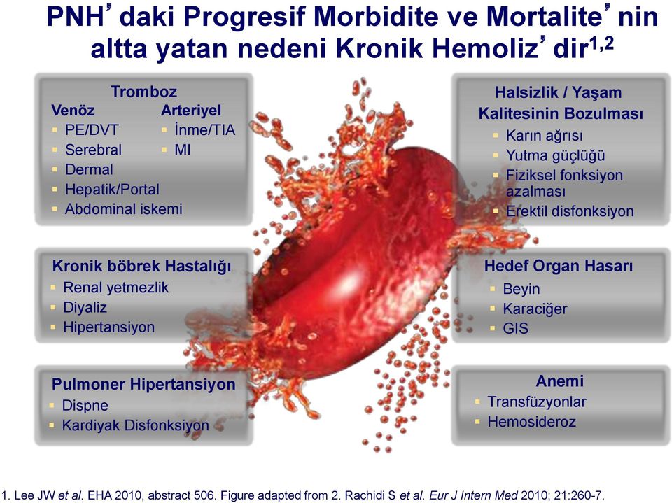 Kronik böbrek Hastalığı Renal yetmezlik Diyaliz Hipertansiyon Hedef Organ Hasarı Beyin Karaciğer GIS Pulmoner Hipertansiyon Dispne Kardiyak